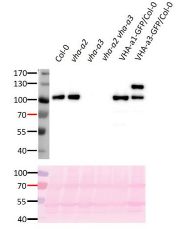 Westen blot using anti-V-ATPase, a3 antibodies